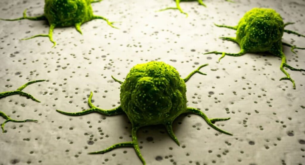 Marihuana może wydłużyć życie chorym na raka trzustki?